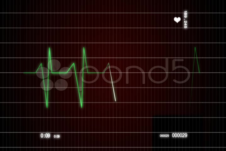 After Effects Project - Pond5 ECG Cardiovascular heart monitor 954174 After Effects Project - Pond5 ECG Cardiovascular heart monitor 954174