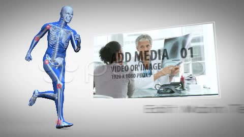 After Effects Project - Pond5 Targeted Pain zones Joints 11989161 After Effects Project - Pond5 Targeted Pain zones Joints 11989161