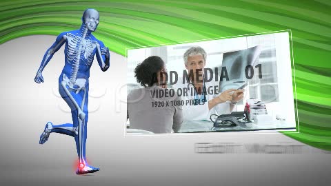 After Effects Project - Pond5 Pain zone Ankle-foot 11989561 After Effects Project - Pond5 Pain zone Ankle-foot 11989561