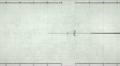 Cardiogram Paintings
