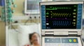 ICU patient with ECG
