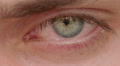 opening and closing of one eye of young man very sad - tears - allergy Video