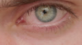 opening and closing of one eye of young man very sad - tears - allergy Video