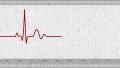 Pulse