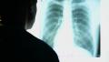 Doctor looking at X-ray image of human chest, scanning lungs Video