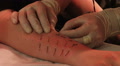 Piercing on the body. Video