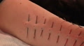 Piercing on the body. Video
