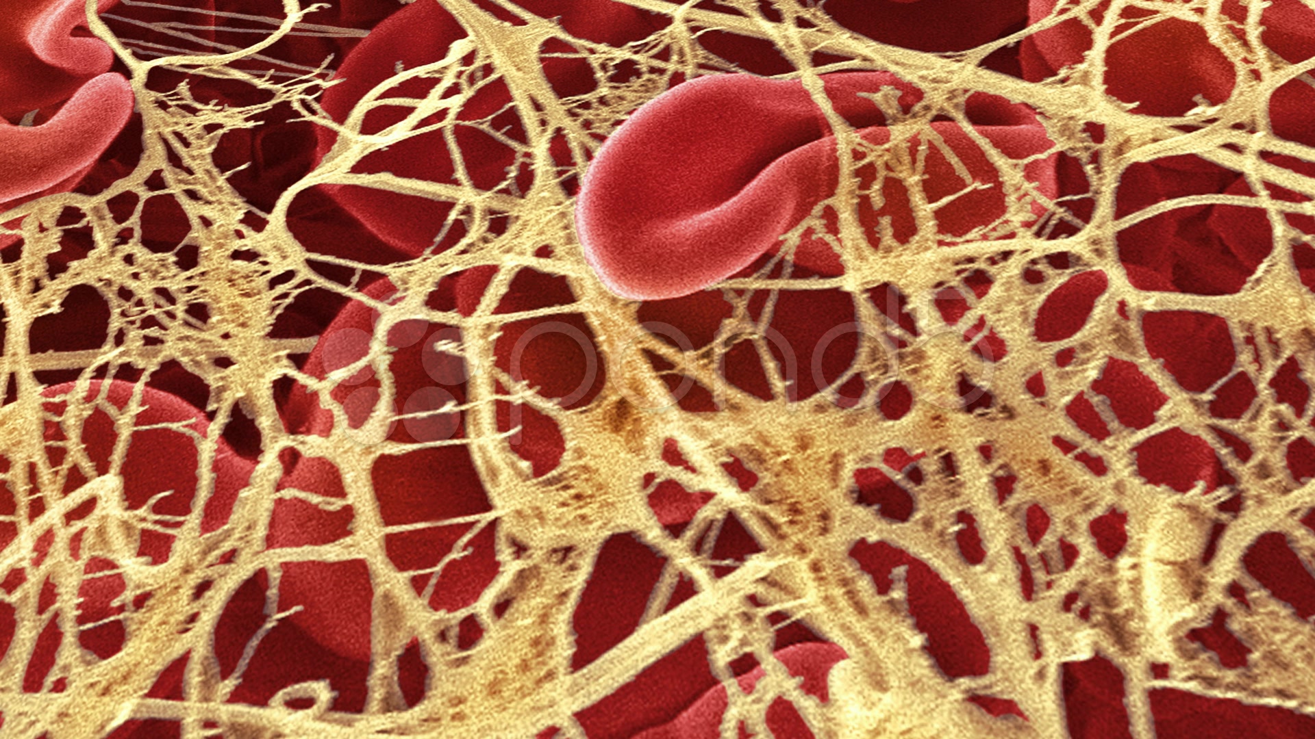 эритроциты под микроскопом. фибрин под микроскопом. фибрин свертывание крови. тромбоцитарно-фибриновый сгусток. фибрин капилляры.