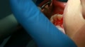 video clip 10767311