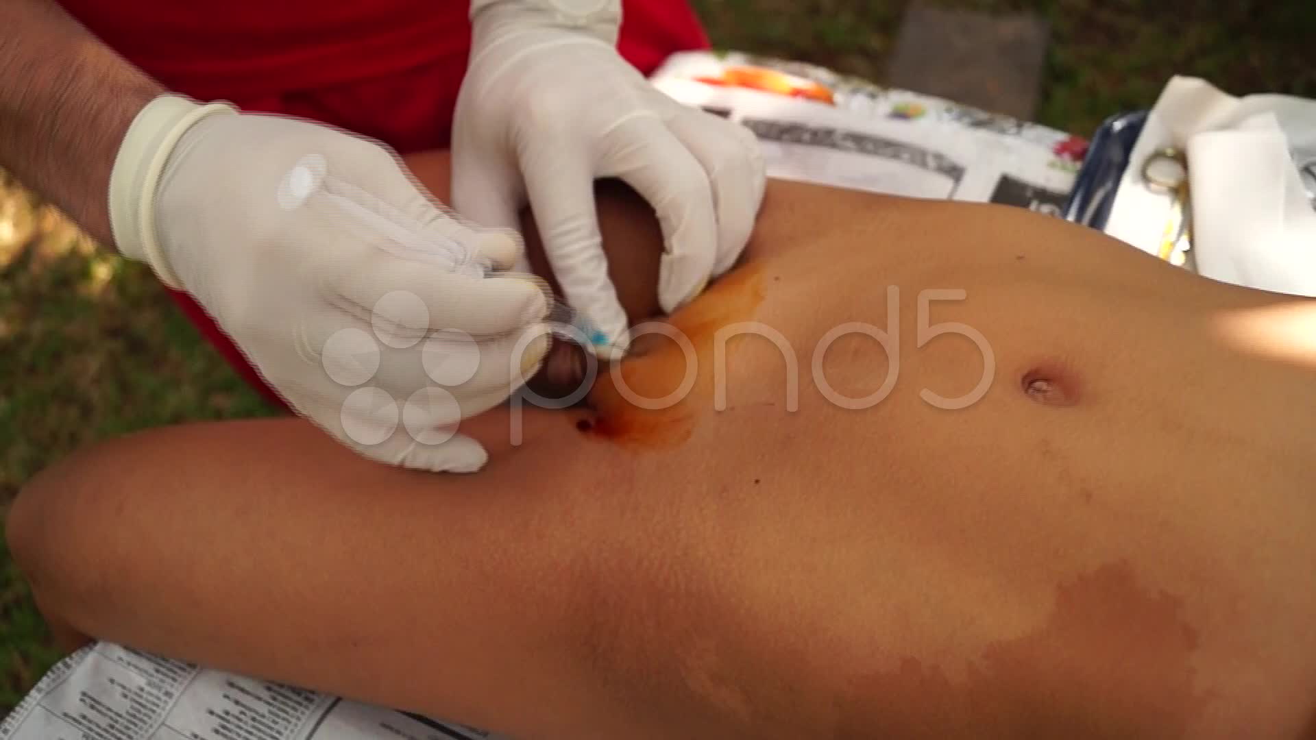 stock video inject able anesthesia 22930969 pond5 stock video inject able anesthesia 22930969 pond5
